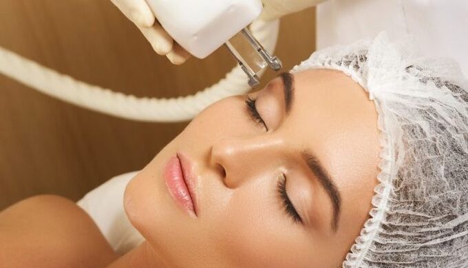 ترمولیفتینگ