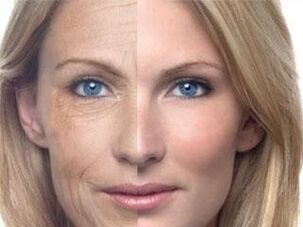 رنگدانه های پوست